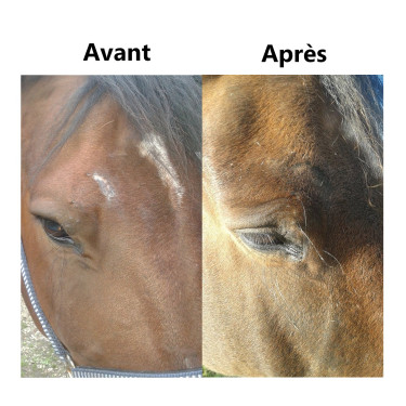 Repousse du poil Ekin Repousse du poil Ekin